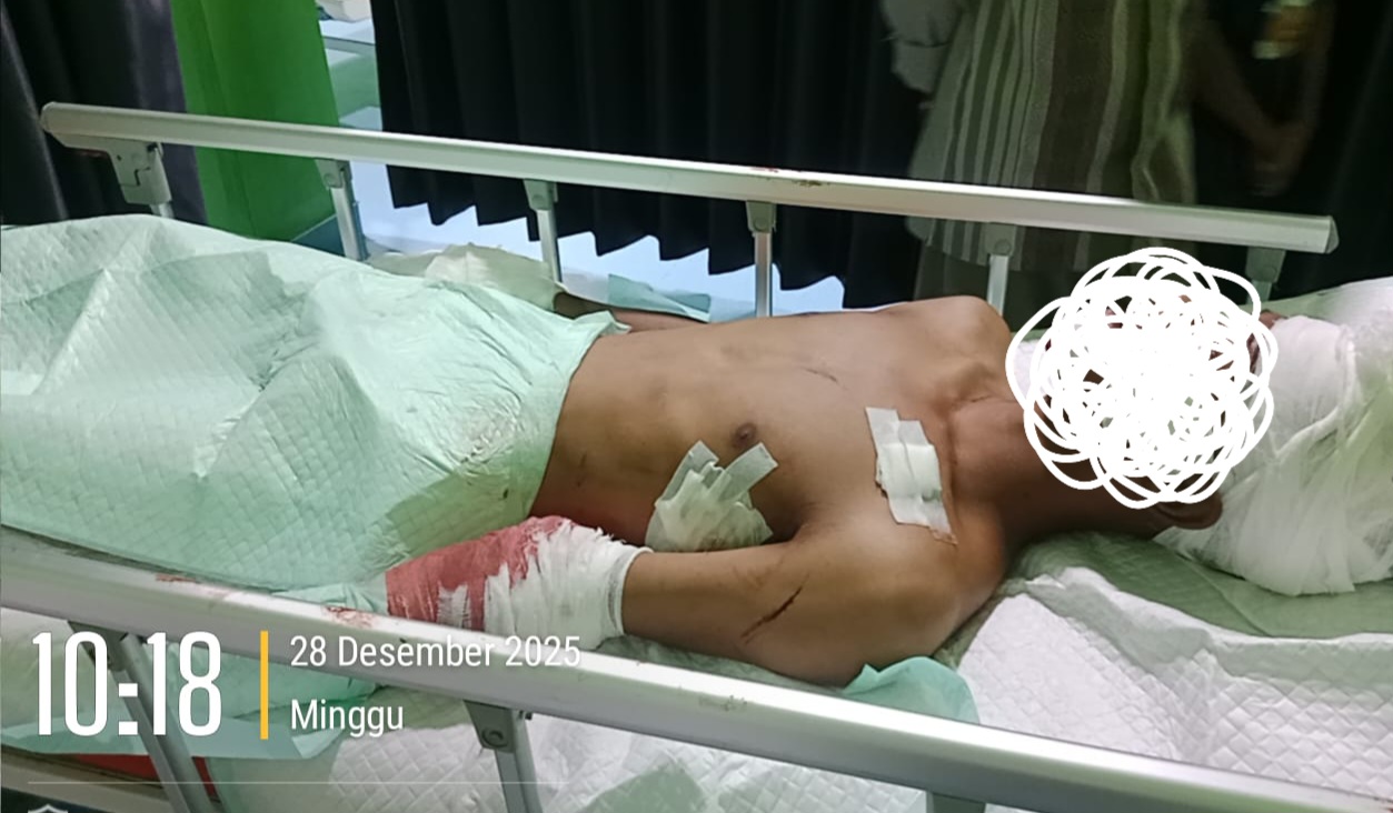 Tukang Las Dibacok di Aceh Singkil, Pelaku Diduga Kabur Usai Serang Korban Saat Tidur ‎