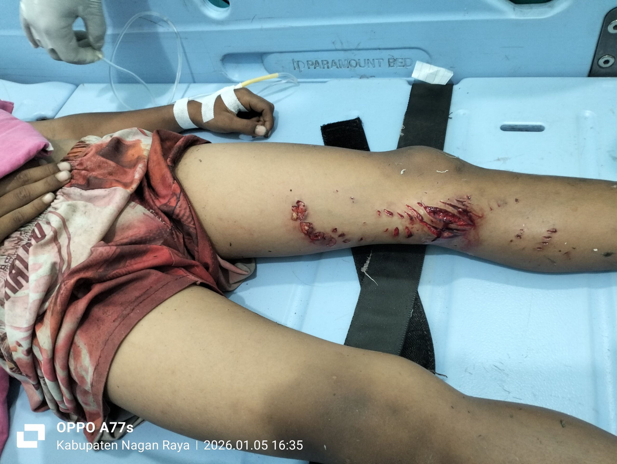 Bocah di Kuala Pesisir Diserang Ular Phyton, Polisi dan Warga Sigap Lakukan Penyelamatan Bocah di Kuala Pesisir Diserang Ular Phyton, Polisi dan Warga Sigap Lakukan Penyelamatan